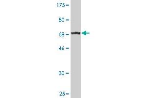 Western Blot detection against Immunogen (63. (BDH1 antibody  (AA 1-343))