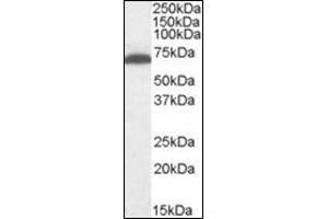 Antibody (1 µg/ml) staining of Mouse Brain lysate (35 µg protein in RIPA buffer). (GAD antibody  (Internal Region))