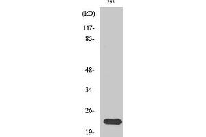 Western Blotting (WB) image for anti-N/H/K-Ras antibody (ABIN5956741) (N/H/K-Ras antibody)