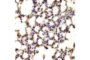 Immunohistochemistry of paraffin-embedded Mouse lung using BHLHE40 antibody at dilution of 1:100 (x400 lens).