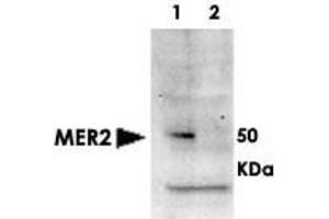 Western blot using MER2 (phospho S30) polyclonal antibody  shows detection of phosphorylated MER2 in whole cell extracts.