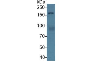 Western blot analysis of Human HeLa cell lysate, using Mouse Rock1 Antibody (2 µg/ml) and HRP-conjugated Goat Anti-Rabbit antibody (