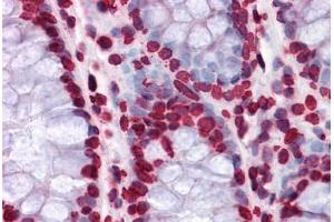 Human Colon: Formalin-Fixed, Paraffin-Embedded (FFPE) (HIPK1 antibody  (AA 330-430))