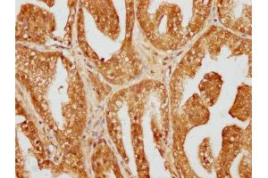 DYNC1LI1 antibody  (AA 167-233)