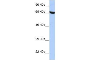 WB Suggested Anti-ZNF528 Antibody Titration:  0. (ZNF528 antibody  (Middle Region))
