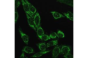 Immunofluorescence Analysis of PFA fixed HeLa cells labeling Cytochrome C Recombinant Rabbit Monoclonal Antibody (CYCS/3128R) followed by Goat anti-rabbit IgG-CF488 (Green) (Recombinant Cytochrome C antibody)