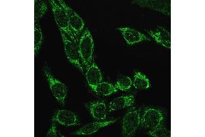 Immunofluorescence Analysis of PFA fixed HeLa cells labeling Cytochrome C Recombinant Rabbit Monoclonal Antibody (CYCS/3128R) followed by Goat anti-rabbit IgG-CF488 (Green)