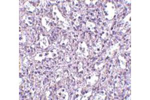 Immunohistochemistry of TBC1D10C in human spleen tissue with TBC1D10C polyclonal antibody  at 2.