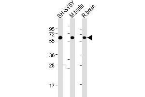 All lanes : Anti-DPYL5 Antibody at 1:4000 dilution Lane 1: SH-SY5Y whole cell lysates Lane 2: mouse brain lysates Lane 3: rat brain lysates Lysates/proteins at 20 μg per lane. (DPYSL5 antibody)