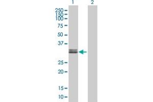 Lane 1: IGFBP2 transfected lysate ( 35. (IGFBP2 293T Cell Transient Overexpression Lysate(Denatured))