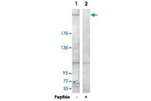Western blot analysis of extracts from HepG2 cells, using LAMB1 polyclonal antibody . (Laminin beta 1 antibody  (C-Term))