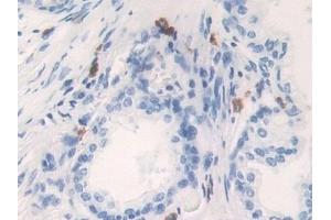 Detection of KLK6 in Human Prostate Tissue using Polyclonal Antibody to Kallikrein 6 (KLK6) (Kallikrein 6 antibody  (AA 17-244))