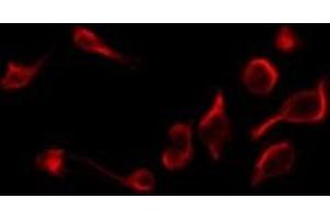 ABIN6269015 staining RAW264. (TNFRSF1B antibody  (C-Term))