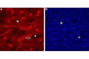 Expression of Muscarinic acetylcholine receptor M1 in mouse striatum - Immunohistochemical staining of mouse striatum using Anti-CHRM1 (443-458) Antibody (ABIN7043061, ABIN7044590 and ABIN7044591), (1:100). (CHRM1 antibody  (C-Term, Intracellular))