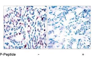 Image no. 1 for anti-Signal Transducer and Activator of Transcription 3 (Acute-Phase Response Factor) (STAT3) (pTyr705) antibody (ABIN196690) (STAT3 antibody  (pTyr705))