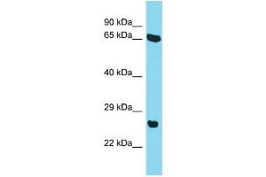 Host: Rabbit Target Name: C22orf23 Sample Type: HepG2 Whole Cell lysates Antibody Dilution: 1. (C22orf23 antibody  (Middle Region))