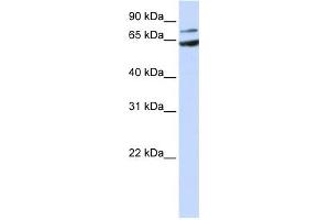 FZD8 antibody used at 1 ug/ml to detect target protein. (FZD8 antibody)