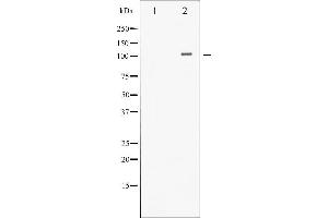 Western blot analysis of HDAC4 phosphorylation expression in CalyculinA treated Jurkat whole cell lysates,The lane on the left is treated with the antigen-specific peptide. (HDAC4 antibody  (pSer632))