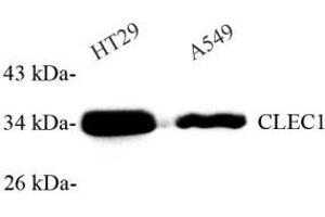 Western blot analysis of CLEC1 (ABIN7073246) at dilution of 1: 1000 (CLEC1A antibody)