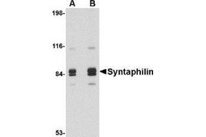 Western blot analysis of Syntaphilin in rat brain tissue lysate with this product at (A) 1 and (B) 2 μg/ml.