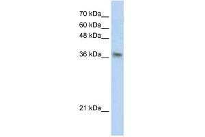 WB Suggested Anti-PHYHIP Antibody Titration:  0. (PHYHIP antibody  (N-Term))