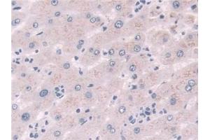Detection of NQO1 in Human Liver Tissue using Polyclonal Antibody to NADH Dehydrogenase, Quinone 1 (NQO1) (NQO1 antibody  (AA 2-274))