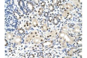 CACNB1 antibody was used for immunohistochemistry at a concentration of 4-8 ug/ml to stain Epithelial cells of renal tubule (arrows) in Human Kidney. (CACNB1 antibody  (Middle Region))