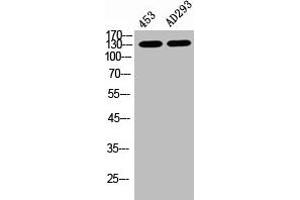 Western Blot analysis of 453 AD293 cells using Phospho-PERK (T981) Polyclonal Antibody (PERK antibody  (pThr981))