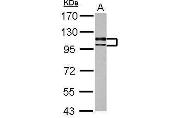 USP4 antibody  (Center)