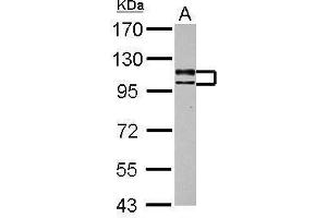USP4 antibody  (Center)