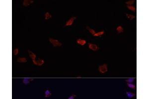 Immunofluorescence analysis of HeLa cells using BMPR2 Polyclonal Antibody at dilution of 1:100.