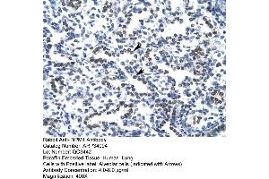 Human Lung (NPM1 antibody  (N-Term))