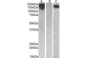 Western Blotting (WB) image for anti-Colony Stimulating Factor 1 Receptor (CSF1R) (Internal Region) antibody (ABIN2464715) (CSF1R antibody  (Internal Region))