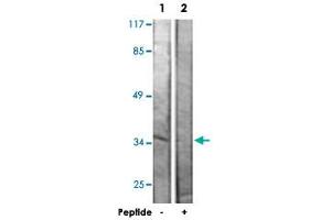 Western blot analysis of extracts from Jurkat cells, using ZFP36L1 polyclonal antibody . (ZFP36L1 antibody)