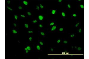 Immunofluorescence of monoclonal antibody to ZFHX1B on HeLa cell. (ZEB2 antibody  (AA 1115-1214))