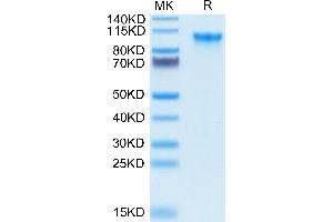 Biotinylated Human CD93/C1q R1 on Tris-Bis PAGE under reduced condition. (CD93 Protein (CD93) (AA 22-580) (His-Avi Tag,Biotin))