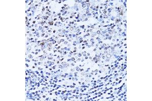 Immunohistochemistry (Paraffin-embedded Sections) (IHC (p)) image for anti-Poly (ADP-Ribose) Polymerase 1 (PARP1) (AA 81-390) antibody (ABIN6145232)