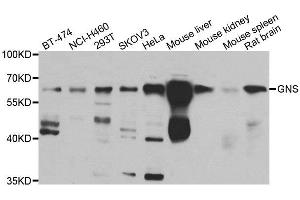 Western blot analysis of extracts of various cell lines, using GNS antibody. (GNS antibody)