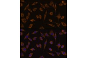 Immunofluorescence analysis of L929 cells using UGT1 Rabbit pAb (359) at dilution of 1:100 (40x lens). (UGT1A1 antibody  (AA 1-200))