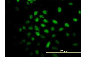 Immunofluorescence of monoclonal antibody to ALS2CR8 on HeLa cell. (Calcium Responsive Transcription Factor (CARF) (AA 621-718) antibody)