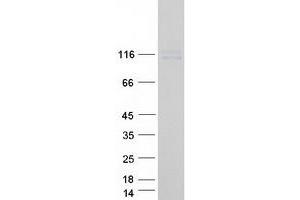 Validation with Western Blot (LY9 Protein (Transcript Variant 1) (Myc-DYKDDDDK Tag))