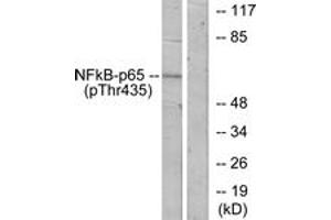 Western blot analysis of extracts from COS7 cells treated with TNF-alpha, using NF-kappaB p65 (Phospho-Thr435) Antibody. (NF-kB p65 antibody  (pThr435))