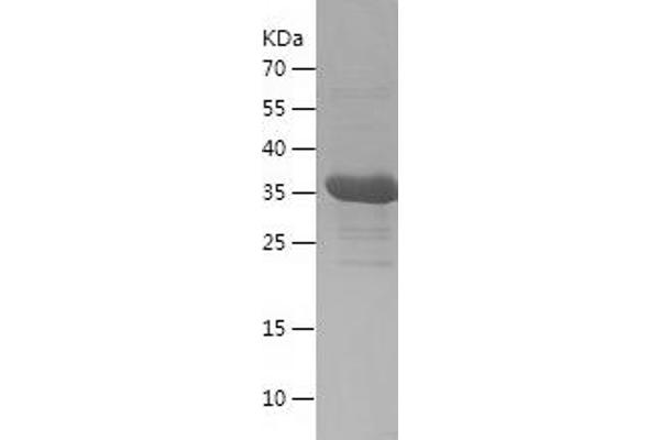 SUMO2 Protein (AA 1-93) (His-IF2DI Tag)