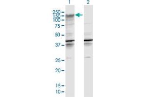 Western Blot analysis of ENPP2 expression in transfected 293T cell line by ENPP2 MaxPab polyclonal antibody. (ENPP2 antibody  (AA 1-863))