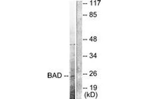 Western Blotting (WB) image for anti-BCL2-Associated Agonist of Cell Death (BAD) (AA 21-70), (Cleaved-Asp71) antibody (ABIN2891153) (BAD antibody  (Cleaved-Asp71))
