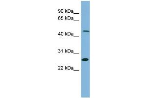 WB Suggested Anti-UPB1  Antibody Titration: 0. (UPB1 antibody  (Middle Region))