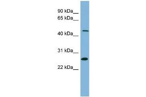 WB Suggested Anti-UPB1  Antibody Titration: 0.