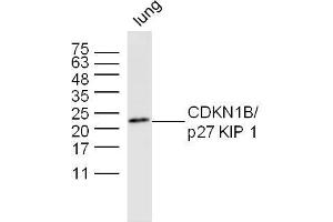 Mouse lung lysates probed with CDKN1B Polyclonal Antibody, unconjugated  at 1:300 overnight at 4°C followed by a conjugated secondary antibody at 1:10000 for 60 minutes at 37°C.