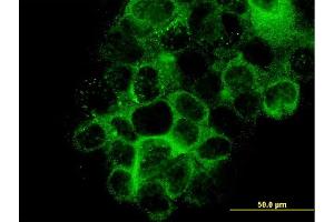 Immunofluorescence of monoclonal antibody to LAMB3 on A-431 cell. (Laminin beta 3 antibody  (AA 1064-1171))