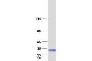 HscB Iron-Sulfur Cluster Co-Chaperone Homolog (HSCB) protein (Myc-DYKDDDDK Tag)